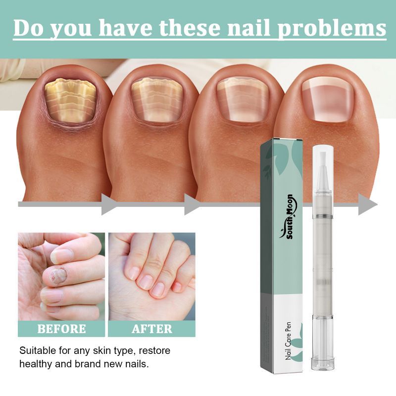Carlmora™ Nails Repair Pen