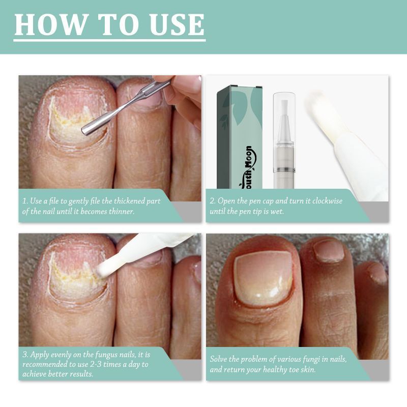 Carlmora™ Nails Repair Pen